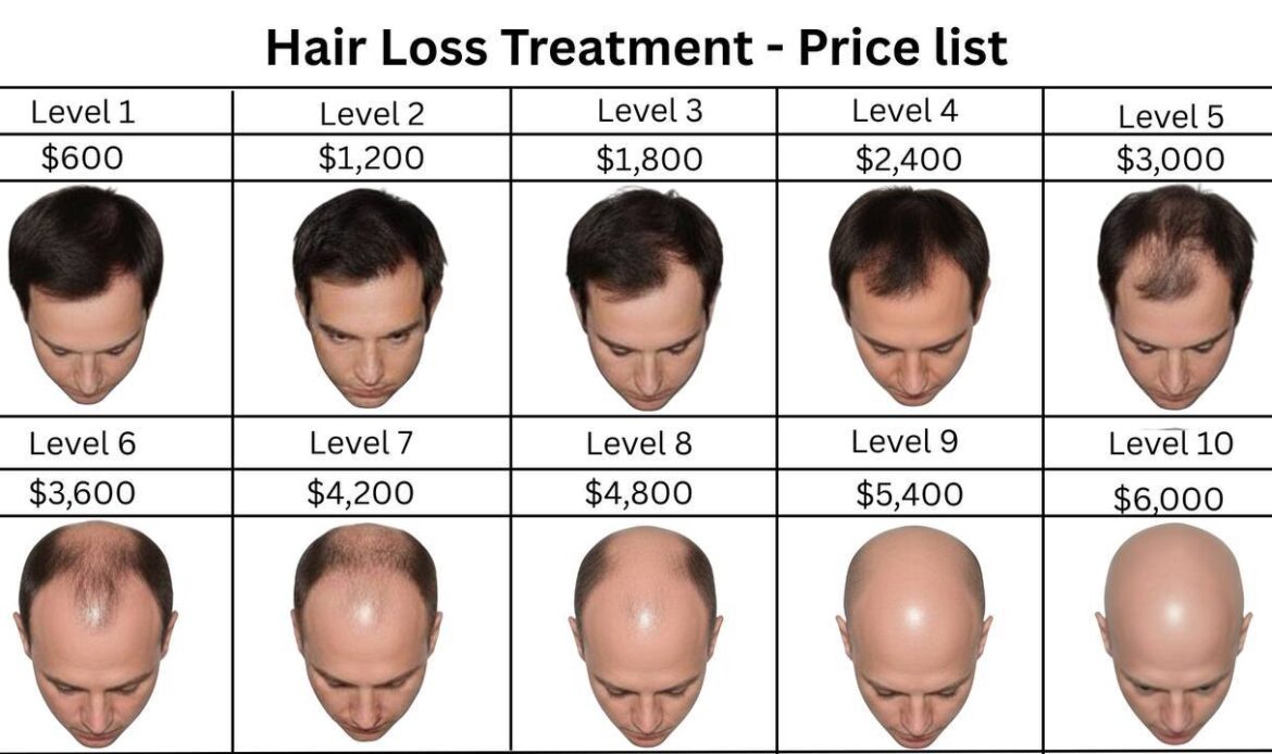 Hair Loss Treatment